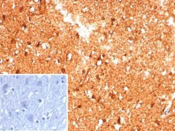 IHC staining of FFPE human brain tissue with Creatine phosphokinase BB antibody (clone CKBB/8609R). 