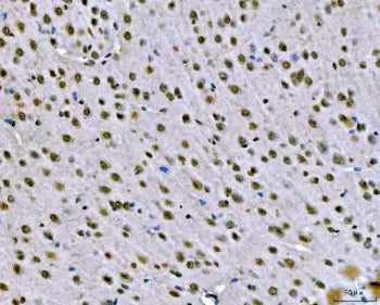 SNRPN Antibody