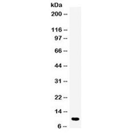 Western blot testing of human placenta lysate with DBI antibody at 0.5ug/ml. Predicted molecular wei