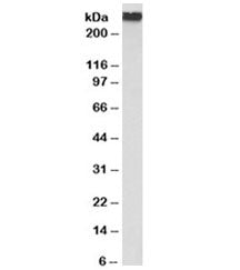 Western blot testing of human uterus lysate with Filamin A antibody at 0.1ug/ml. Predicted molecular