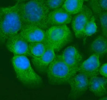 Cytokeratin 20 Antibody / CK20