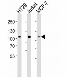 TPX2 Antibody (p100)