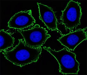 c-Kit Antibody (CD117)