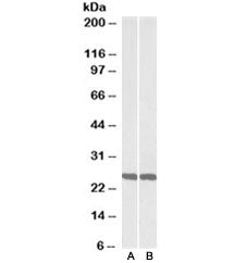 UCHL1 Antibody