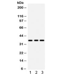 Western blot testing of 1) rat brain, 2) rat liver, and 3) human placenta lysate with IGFBP2 antibod