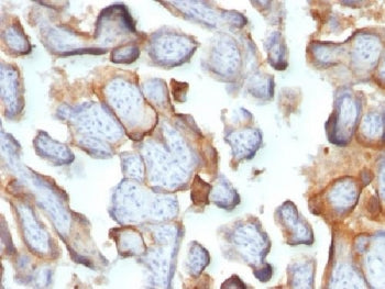 HCG-beta Antibody