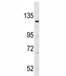 LATS1 Antibody
