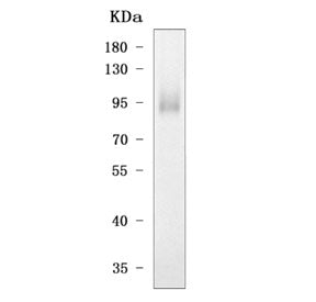 Western blot testing of mouse RAW264.7 cell lysate with Tlr4 antibody. Expected molecular weight: 96