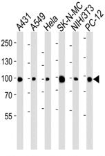Western blot analysis of lysate from A431, A549, HeLa, SK-N-MC, mouse NIH3T3, rat PC-12 cell line us