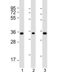 TMEM158 Antibody