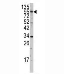 MYLK3 Antibody