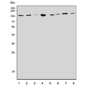 Western blot testing of 1) rat brain, 2) rat liver, 3) rat heart, 4) rat kidney, 5) mouse brain, 6) 