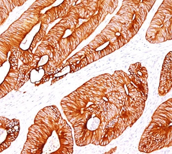 KRT8 Antibody / Cytokeratin 8