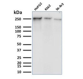 Western blot testing of human HepG2, K562, and SK-BR-3 cell lysate with phospho-RNA polymerase II an