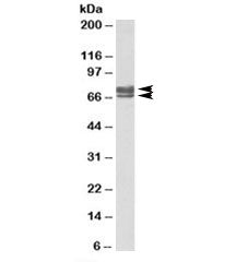 Western blot testing of human kidney lysate with PEX5 antibody at 0.1ug/ml. In this test, isoform a 