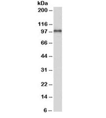 Western blot of human heart lysate with ADAM12 antibody at 0.1ug/ml. Predicted molecular weight: ~99