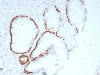 IHC staining of FFPE human prostate tissue with Cytokeratin 14 antibody (clone rKRT14/8692) at 2ug/m