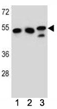 TUBB6 Antibody (Tubulin beta 6)