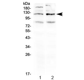 Western blot testing of 1) rat brain and 2) mouse brain lysate using GABA B Receptor 1 antibody at 0
