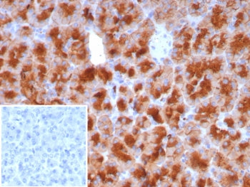 IHC staining of FFPE human pancreas tissue with recombinant ZAP75 antibody (clone GP2/8229R). Inset: