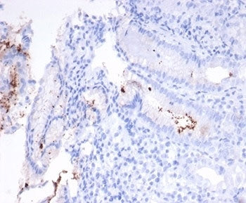 Helicobacter pylori Antibody (Catalase)