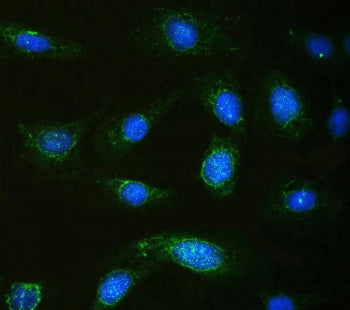 Immunofluorescent staining of FFPE human U-2 OS cells with Calpastatin antibody (green) and DAPI nuc
