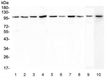 Western blot testing of human 1) placenta, 2) HL-60, 3) 22RV1, 4) 293T, 5) PANC-1, 6) SGC-7901, 7) C