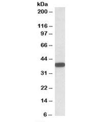 CYB5R3 Antibody