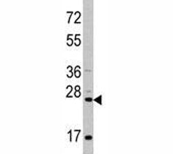 CD8A Antibody