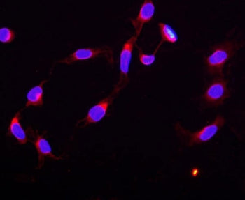 STAT5b Antibody