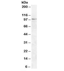 Western blot testing of human liver lysate with OSBP1 antibody at 2ug/ml. Predicted molecular weight