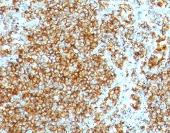 IHC staining of FFPE human lymph node with recombinant HCAM antibody (clone HCM15-2R). HIER: boil ti