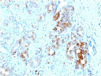 IHC testing of FFPE human prostate with FTL antibody. HIER: boil tissue sections in 10mM citrate buf