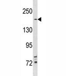 TSC2 Antibody
