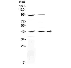 GPR54 Antibody / KISS1R