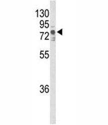 TNK1 Antibody