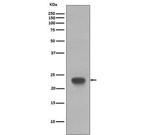 Western blot testing of human Jurkat cell lysate with CD3 epsilon antibody. Predicted molecular weig