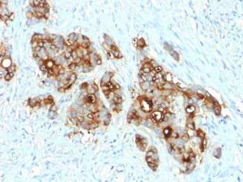 CEA Antibody / Carcinoembryonic Antigen