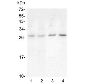 Western blot testing of 1) rat lung, 2) rat spleen, 3) mouse lung and 4) mouse spleen lysate with On