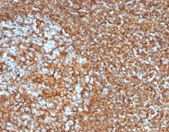 IHC staining of FFPE human tonsil tissue with recombinant Vimentin antibody (clone VIM/6430R). HIER: