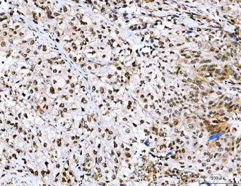 NVL Antibody / Nuclear VCP-like protein