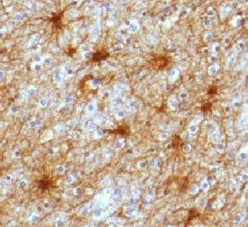 IHC testing of FFPE human brain and GFAP antibody (clone GFA12-3). FFPE testing requires sections to