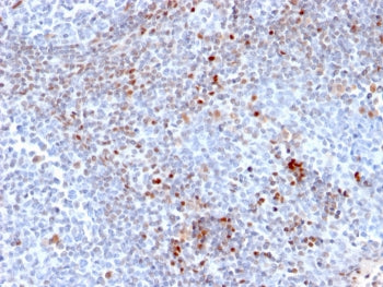 SATB1 Antibody