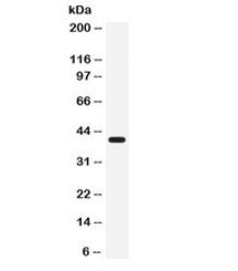 Western blot testing of K562 cell lysate with CD55 antibody. Observed molecular weight: 41~70 kDa de