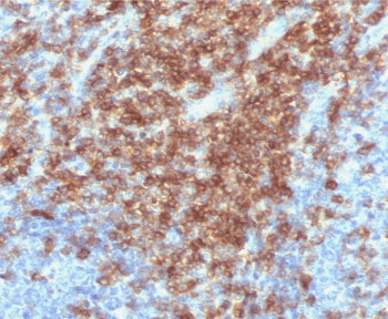 IHC staining of FFPE human tonsil tissue with recombinant CD43 antibody (clone CDLA43-2R). Required 