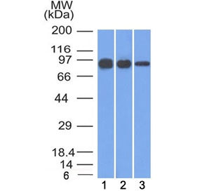 Western blot testing of human 1) A431, 2) A549 and 3) MCF7 cell lysate with Beta Catenin antibody (c