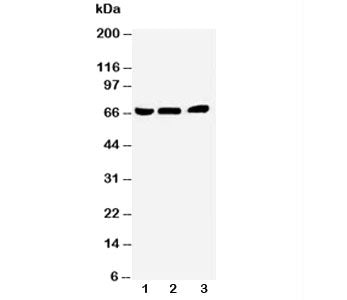Western blot testing of NUR77 antibody and Lane 1: A431; 2: HeLa; 3: Jurkat cell lysate. Predicted m