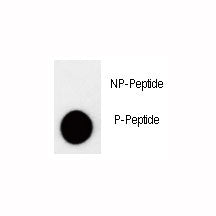 Dot blot analysis of phospho-p27Kip1 antibody. 50ng of phos-peptide or nonphos-peptide per dot were 