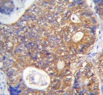 PAICS Antibody / ADE2