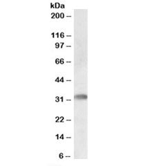 TREML1 Antibody